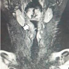 This pride month we want to celebrate and continue supporting the lgbt+ community. A Sani S Research Works Kuala Lumpur Sports Medicine Centre Kuala Lumpur And Other Places