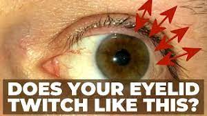 Eyelid Spasms, Twitches, Twitching Driving Me Crazy. Upper Eye Lid  Vibrating, Is This Normal? - Youtube