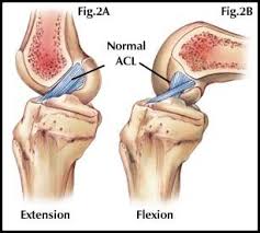 Anterior Cruciate Ligament Acl Salud Y Ejercicio Flexiones Traducir Al Espanol