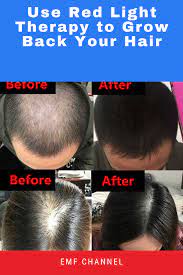Use Red Light Therapy To Grow Back Your Hair Emf Channel In 2021 Red Light Therapy Light Therapy Light Red