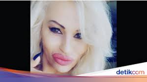 Sisi Gelap Wanita yang 200 Kali Operasi Plastik