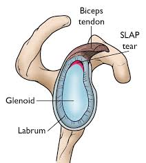 Anatomical terms of location are vital to understanding, and using anatomy. Slap Tears Orthoinfo Aaos