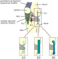 Also called, tibial collateral ligament) extends from the medial epicondyle of the femur to the superior aspect of the medial surface of the tibia at its midpoint it is attached to the medial meniscus Schematic Representation Of The Anatomy Of The Knee Joint Depicting Download Scientific Diagram