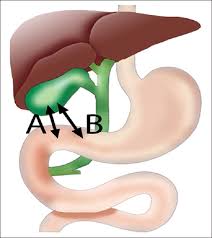 There's even some evidence suggesting a person's age. Endoscopic Ultrasound Table Of Contents