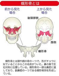 副鼻腔炎 蓄膿症 の対策 鼻水 鼻づまりも後鼻漏も頭痛も防ぐ ほお骨プッシュ カラダネ 副鼻腔炎 副鼻腔 鼻づまり