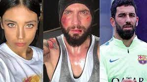 Eğer silah yanlışlıkla ateş almış olsaydı arda vurulurdu. Arda Turan Silah Kazayla Ates Aldi