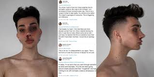 He addressed the feud in a . Mugshot Makeup Challenge Youtuber James Charles Slammed For Posting Photos With Fake Bruises Indy100 Indy100