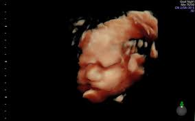 I got to see my little guy today. 34 weeks 1 day. He is adorable. I wish it  could've showed the whole face detail but once it moved a little it showed