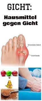 gicht hausmittel gegen gicht gegen gicht hausmittel natural gout remedies home remedies for gout gout help