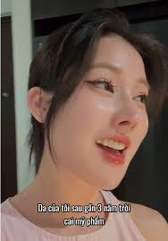 Chăm sóc da khi bị viêm da dị ứng