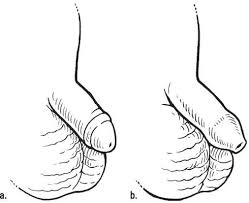 Maybe you would like to learn more about one of these? How To Change Diapers For Dads Dummies