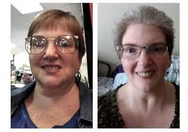 MASTERCLASS: Beyond Lipedema