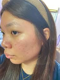 Please what can I use to clear my hands