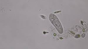 Which instrument can help to see amoeba clearly? Ameba Under Microscope Magn 400x Stock Footage Video 100 Royalty Free 11555831 Shutterstock