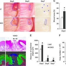 Here are some remedies for tooth extraction healing. Wound Healing After Tooth Extraction Was Delayed In Trpv3ko Mice A Download Scientific Diagram