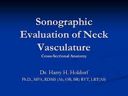 Sonographic Evaluation Of Neck Vasculature Cross Sectional Anatomy Ppt Video Online Download