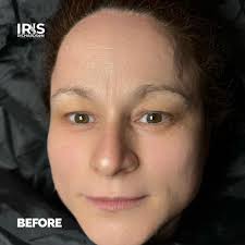 IRIS Richardson Brows