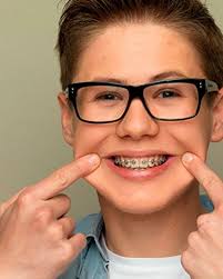Orthodontics Miltonpediatricdentistry Braces Kids Orthodontics Dentistry Pediatric Dentistry