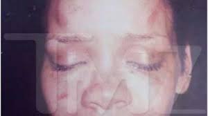 Chris brown is sporting a new neck tattoo: Police Pic Rihanna After Chris Brown Assault That Grape Juice