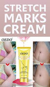 Pin By Jai Davis On Beauty In 2020 Stretch Marks Stretch Mark Cream Beauty Skin Care Routine