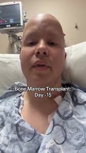 Dr Richard Gilroy Utah Transplant