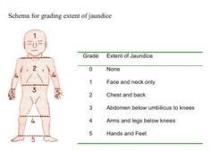 10 Neonate Ideas Pediatric Nursing Nursing Study Pediatrics