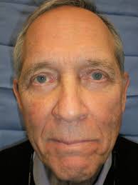 Ophthalmologists in Boise, ID