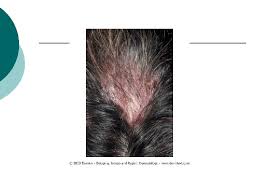 Last medically reviewed on april 28, 2020. Types Of Har Lanugo Hair Soft Fine Hair