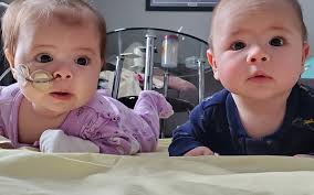 Transplant saves 4-week-old Elsie Freeman after sudden liver failure