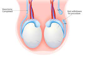 We did not find results for: Vasectomy Dr Hoover M D Primary Care Physician Miami Fl Healthcare Now