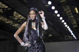 Image result for vitiligo model