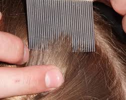 So if you are also looking forward for some perfect hair salon for your hairs then here are some websites you can visit. Tallahassee Lice Treatment Fun 4 Tally Kids