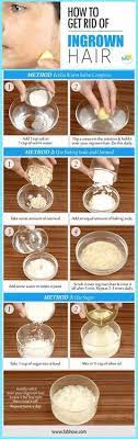 Home Remedy To Remove An Ingrown Hair Quickly Without Laser Ingrown Hair Ingrown Hair Removal Hair Remedies