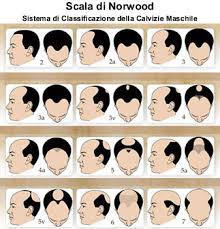 Si tratta di un vero e . Protesi Soluzione Alla Perdita Dei Capelli Nell Uomo Fair Fashion Blog