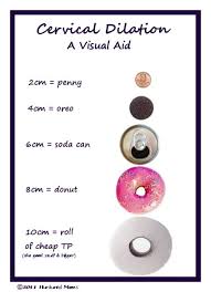 Cervical Dilation A Visual Aid Cervical Dilation Chart Cervix Dilation Midwifery