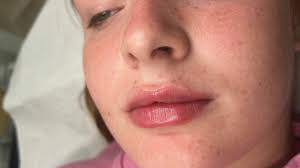 Best Medspas near me in Pallion, Sunderland