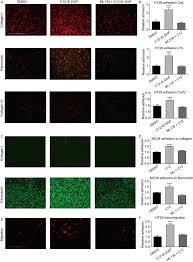 October 2, 2019 at 7:30 am. Activation Of The Pattern Recognition Receptor Nod1 Augments Colon Cancer Metastasis Springerlink