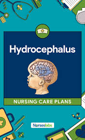 Pin On Nursing Care Plans