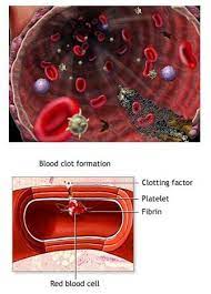 Let The Blood Flow Biomedical Artery Unclogging Experiment Activity Teachengineering