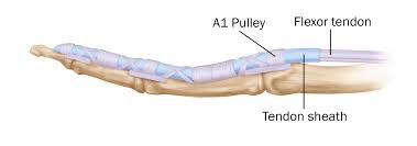 The flexor tendons, located on the palm side of your hand, bend the fingers. Trigger Finger Trigger Thumb Orthoinfo Aaos