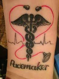 A friend of one of our device nurses who has an implantable cardiac defibrillator (icd) had a truly reflective moment recently when she. Pacemaker Recipient