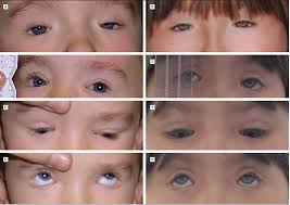 Image result for Blepharis involucrata