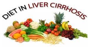 healthy diet for liver cirrhosis patient good and bad