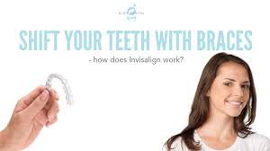 You'll wear the aligners every day and night during your treatment plan (typically for approximately six to 18 months). Shift Your Teeth With Braces How Does Invisalign Work Glen Dental