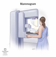 Image result for Mammogram Interpretation