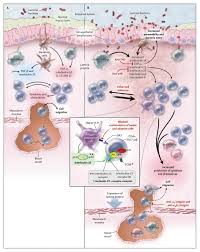 The Intestinal Immune System In Health And Disease Inflammatory Bowel Disease Chronic Inflammatory Disease Immunology