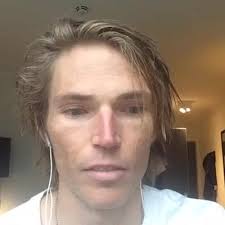 Live Q & A with Vivo elites team member Darryl Ball, #skiingrunningpilot