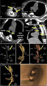 Multi detector ct imaging pdf free download. Utility Of 64 Row Mdct In Assessment Of Neonates With Congenital Ea And Distal Tef Sciencedirect