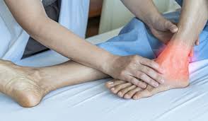 Tarsal Tunnel Syndrome