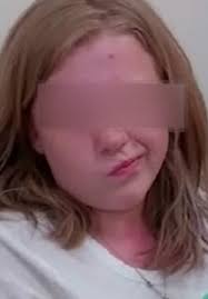 Pediatric Movement Disorders